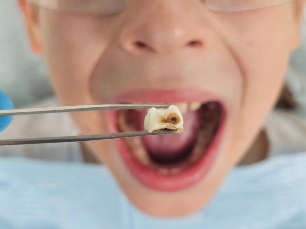Best Emergency Dental Care for Trauma or Injury in Gibsonton, FL