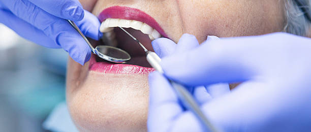 Best Emergency Treatment for Toothache in Gibsonton, FL